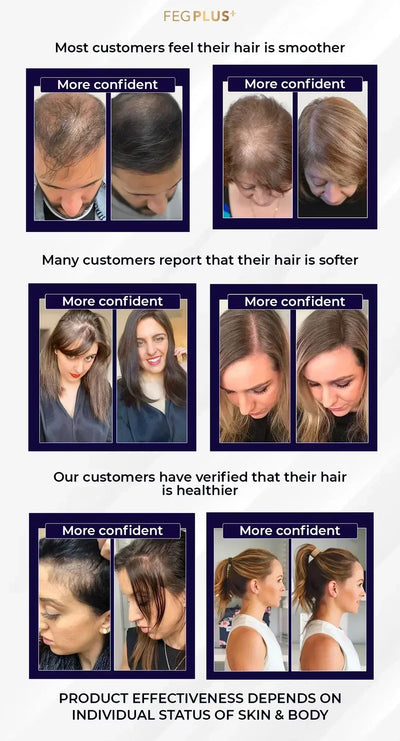 FEG PLUS Hair & Beard Growth Spray