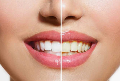 CHARCOAL TEETH SHINING POWDER